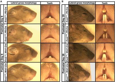 A Ciliary Protein EVC2/LIMBIN Plays a Critical Role in the Skull Base for Mid-Facial Development